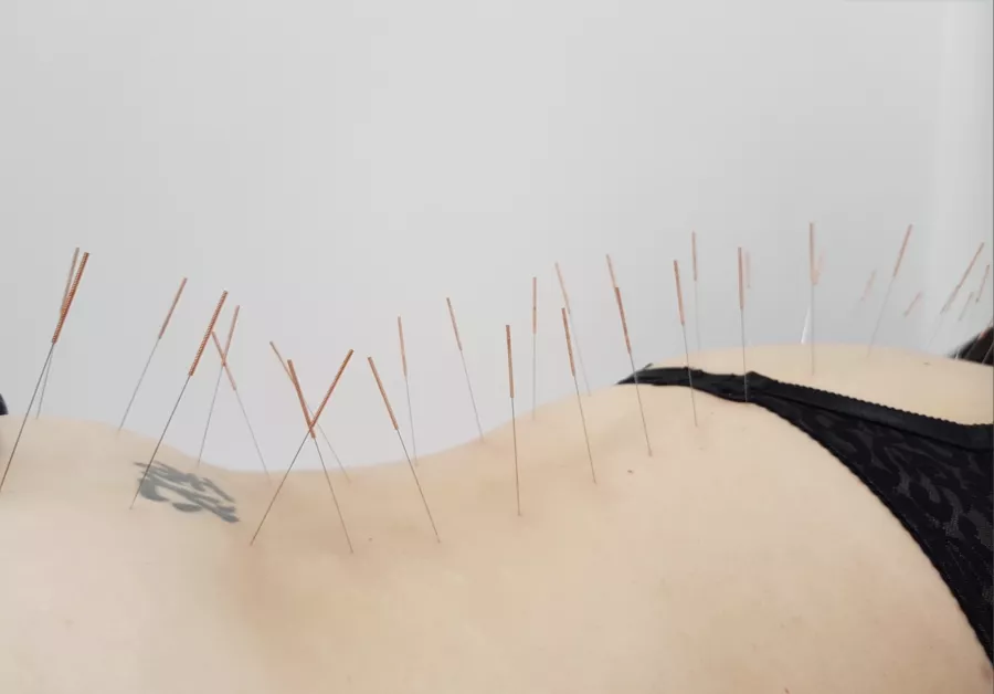 Диагностический центр Charite clinic в Анапе: Косметология, Кожа, Криокосметология,