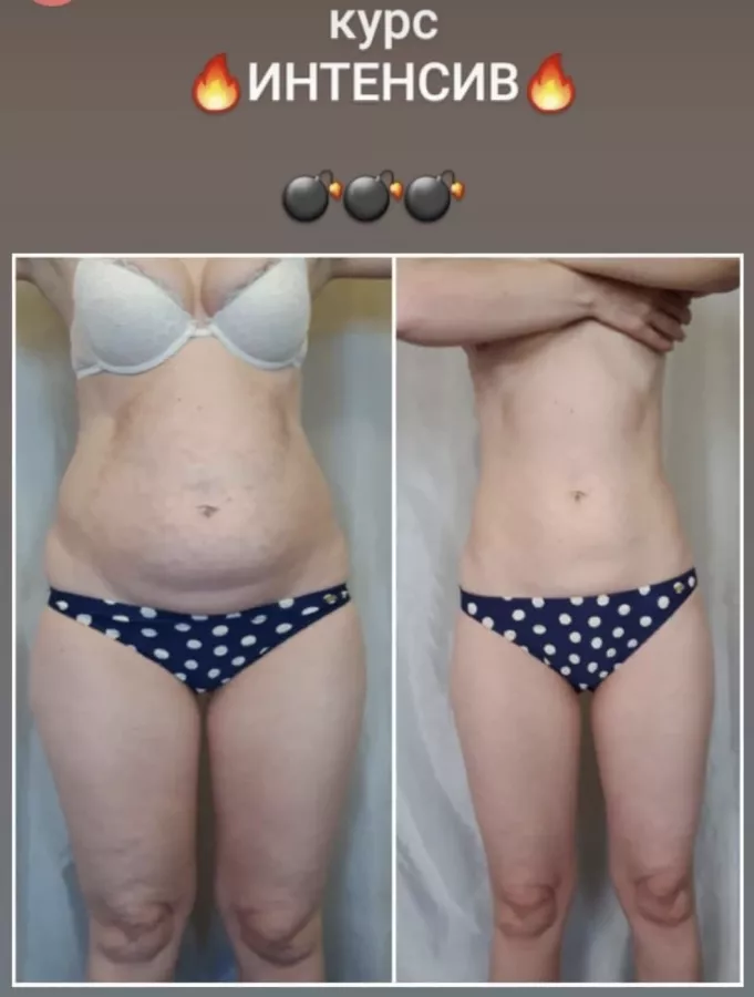 Студия коррекции фигуры FatAway в Сочи: Массаж, Красота,
