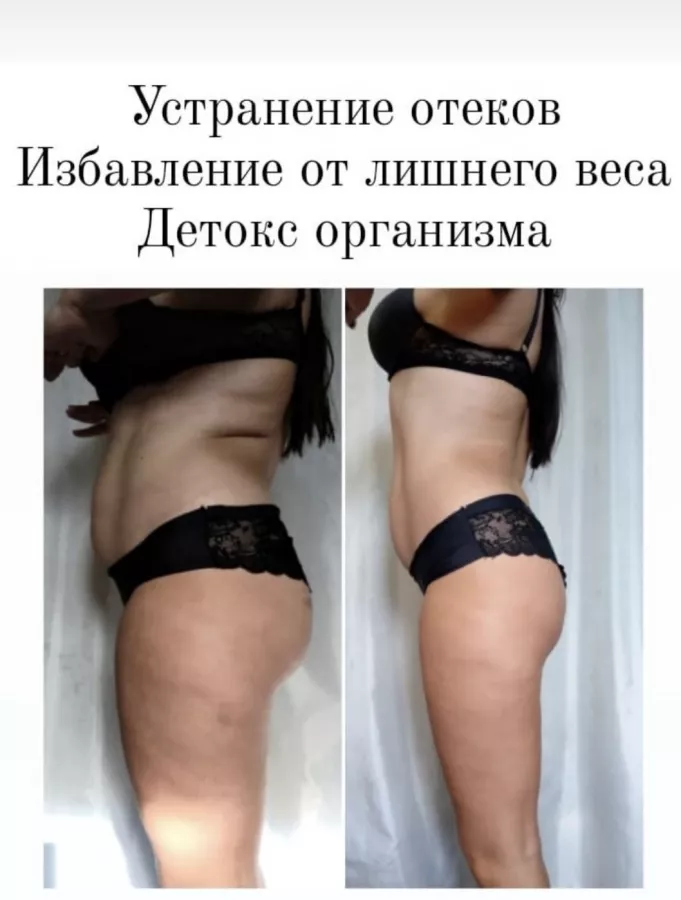 Студия коррекции фигуры FatAway в Сочи: Массаж, Красота,