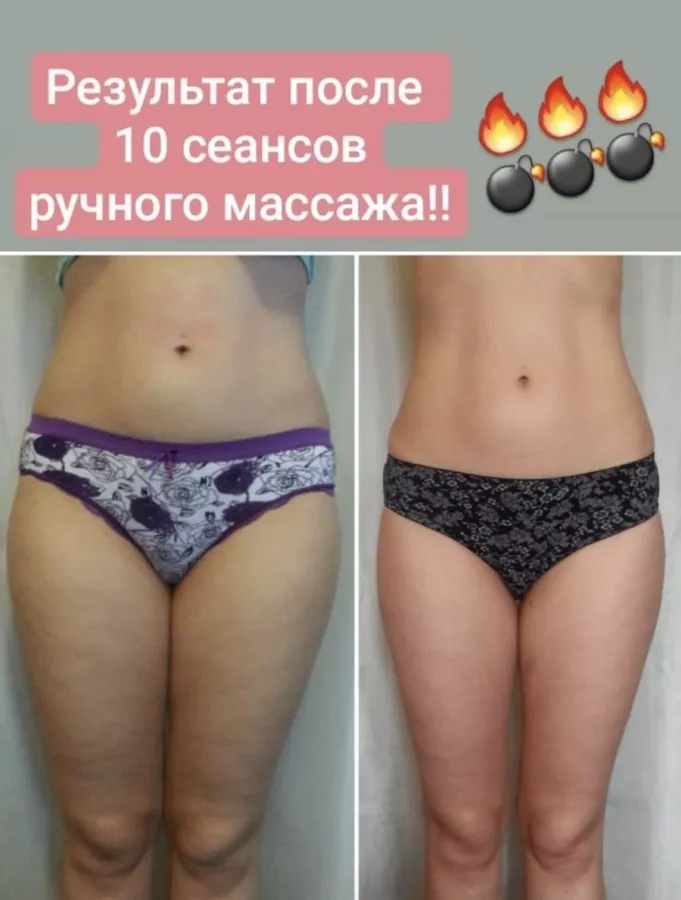 Студия коррекции фигуры FatAway в Сочи: Массаж, Красота,