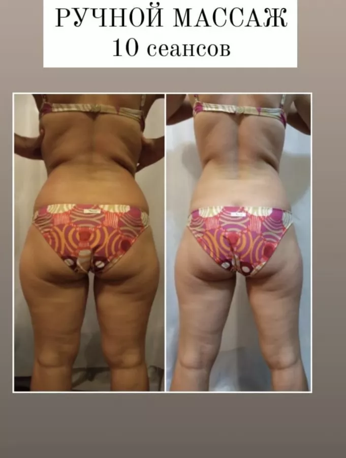 Студия коррекции фигуры FatAway в Сочи: Массаж, Красота,