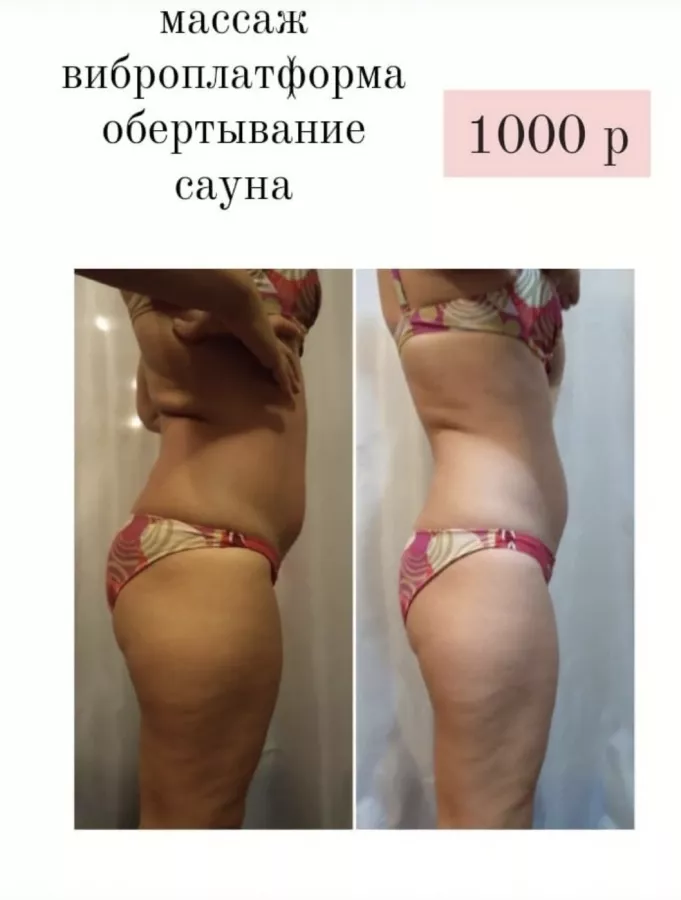 Студия коррекции фигуры FatAway в Сочи: Массаж, Красота,