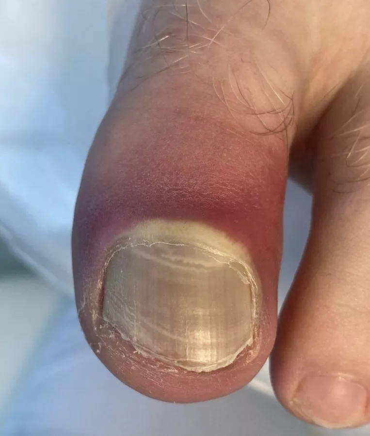 Nail podology кабинет подологии и эстетики в Сочи: Красота,