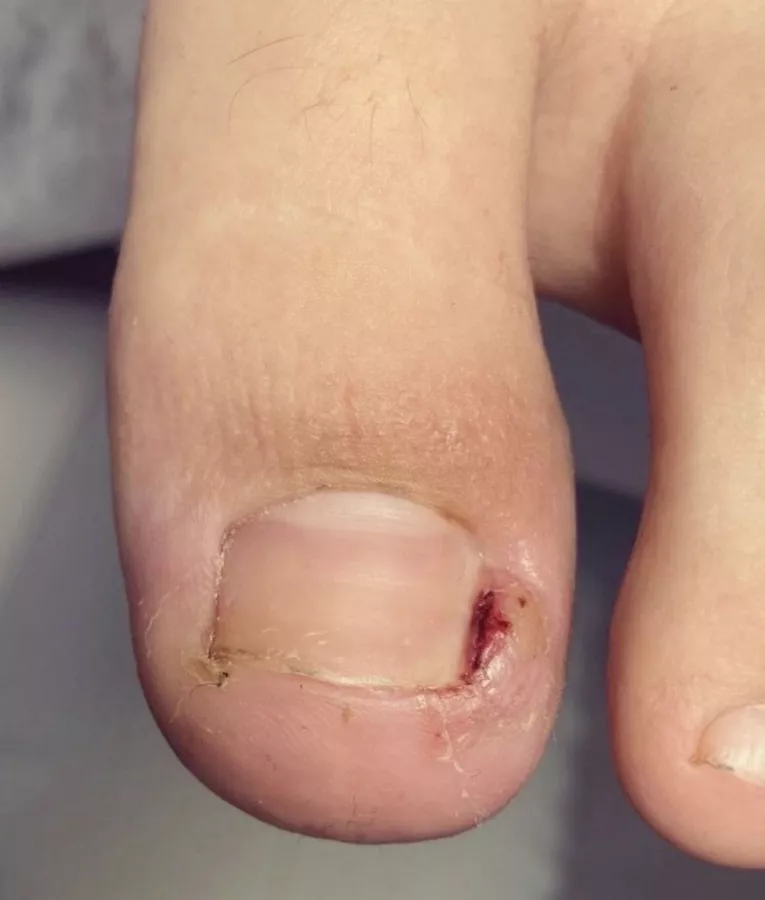 Nail podology кабинет подологии и эстетики в Сочи: Красота,