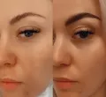 Миниатюра 7