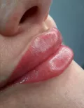 Миниатюра 3