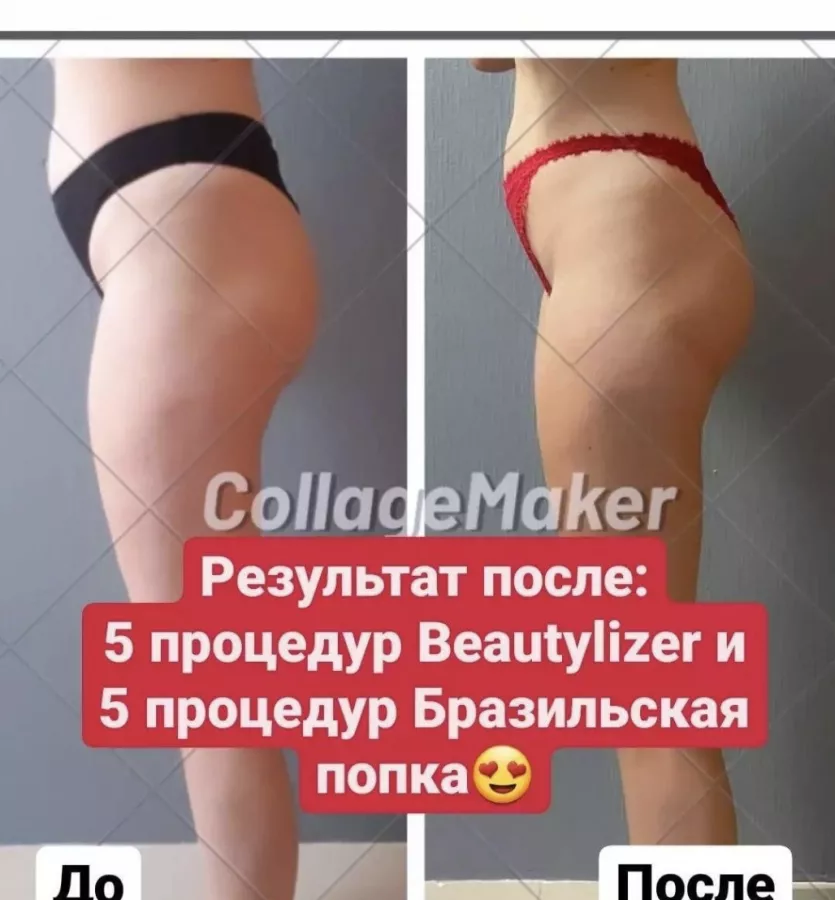 Компания Beautylizer в Адлере: Массаж,