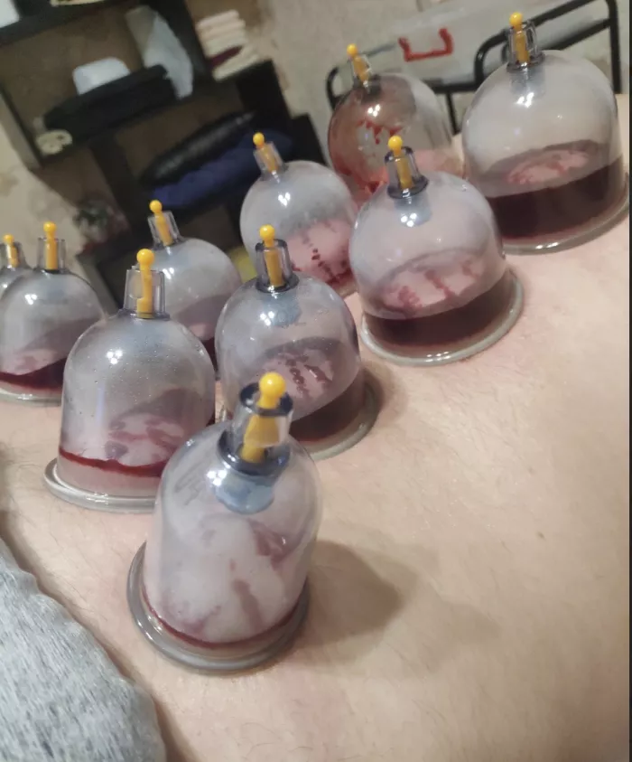 Кабинет "Массажа и хиджамы "