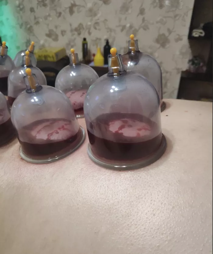 Кабинет "Массажа и хиджамы "