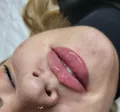 Миниатюра 5