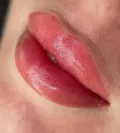 Миниатюра 11