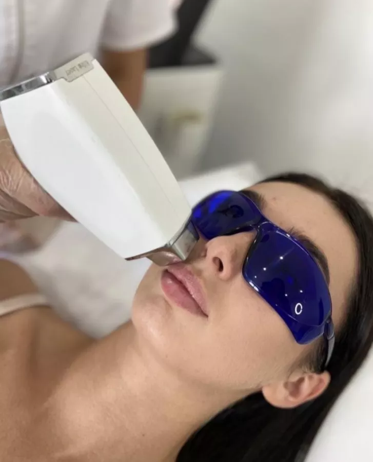 Студия эпиляции LW Laser Studio в Краснодаре: Красота, Студия,