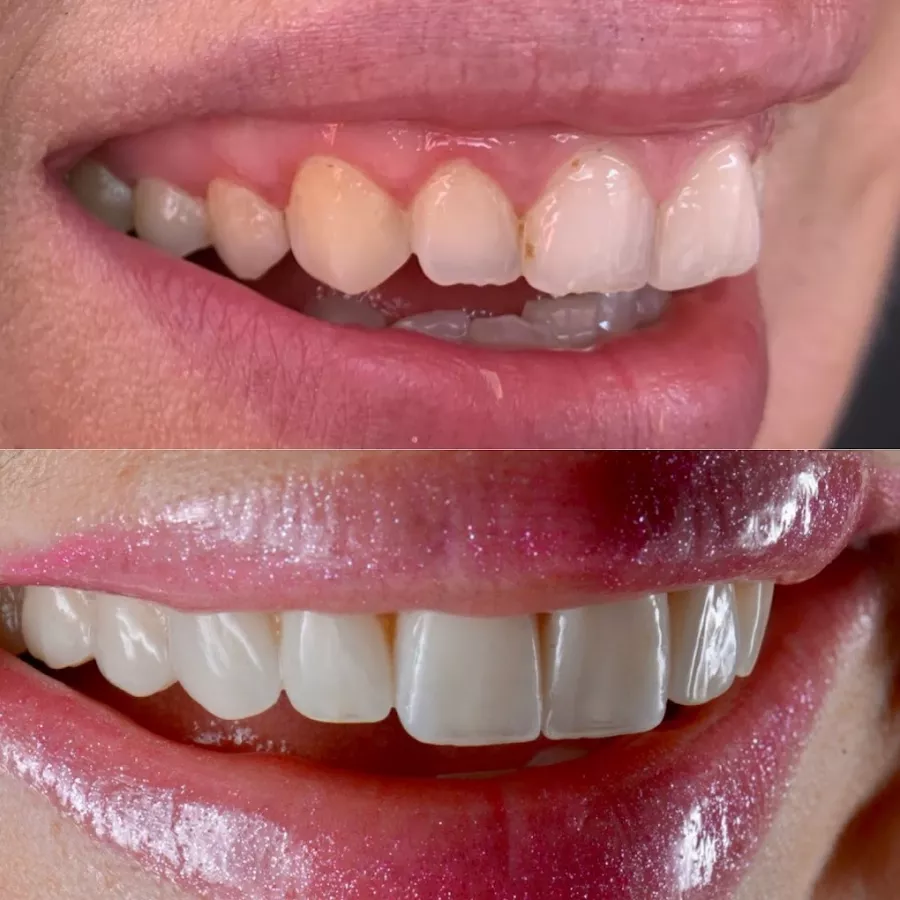 Стоматологическая клиника DentAntalya (Oral & Dental Health Clinic) в Анталии: Стоматологическая клиника, Стоматология, Зубы, Лечение зубов,