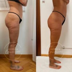 Салон красоты Estetica Cruciani Milano в Милане: Чистка, Лечение, Лимфодренаж, Массаж, Красота,