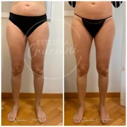 Салон красоты Estetica Cruciani Milano в Милане: Чистка, Лечение, Лимфодренаж, Массаж, Красота,