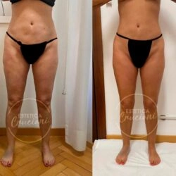 Салон красоты Estetica Cruciani Milano в Милане: Чистка, Лечение, Лимфодренаж, Массаж, Красота,