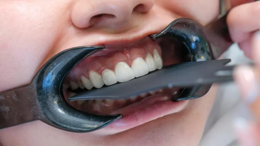 Стоматологическая клиника MakiDent Dental Clinic - Maki Dent Ağız ve Diş Sağlığı Polikliniği в Анталии: Стоматологическая клиника, Стоматология, Зубы, Лечение зубов,