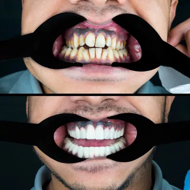 Стоматологическая клиника "MakiDent Dental Clinic - Maki Dent Ağız ve Diş Sağlığı Polikliniği"