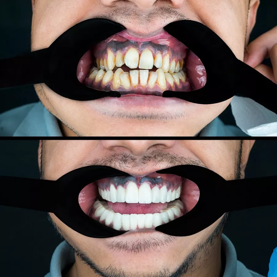 Стоматологическая клиника MakiDent Dental Clinic - Maki Dent Ağız ve Diş Sağlığı Polikliniği в Анталии: Стоматологическая клиника, Стоматология, Зубы, Лечение зубов,