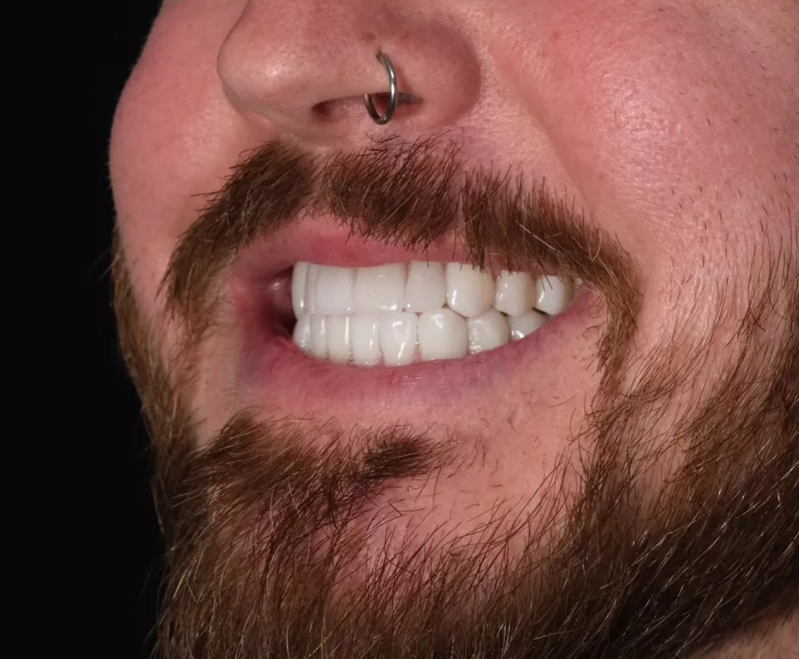 Стоматологическая клиника MakiDent Dental Clinic - Maki Dent Ağız ve Diş Sağlığı Polikliniği в Анталии: Стоматологическая клиника, Стоматология, Зубы, Лечение зубов,