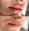 Миниатюра 16