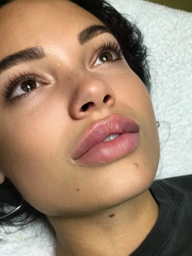 Косметология Dr. Baby_Face в Ростове-на-Дону: Пилинг, Здоровье,