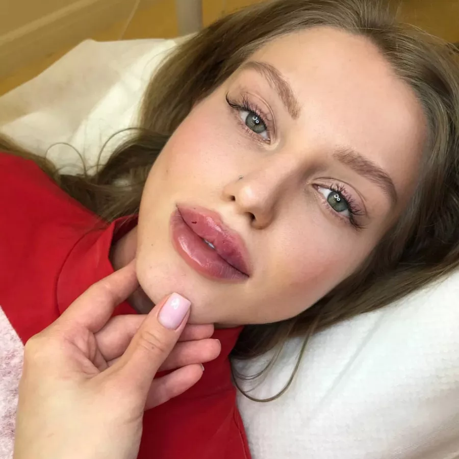 Косметология Dr. Baby_Face в Ростове-на-Дону: Пилинг, Здоровье,
