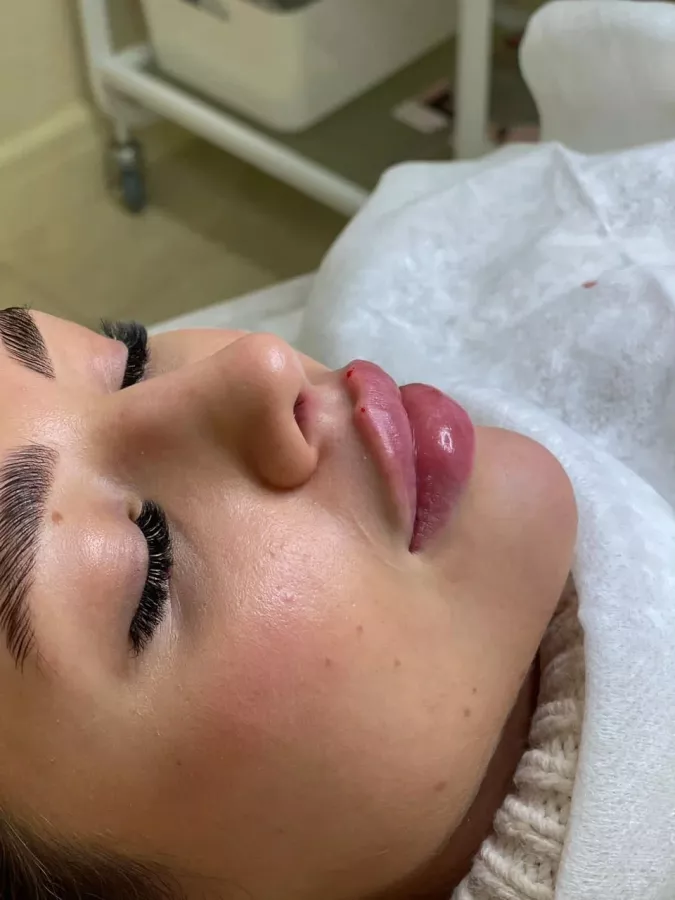 Косметология Dr. Baby_Face в Ростове-на-Дону: Пилинг, Здоровье,