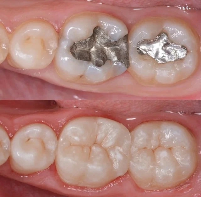 Стоматологическая клиника Kurazyan Dental Centre в Ростове-на-Дону: Стоматологическая клиника, Стоматология, Лечение зубов,