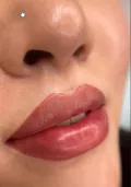 Миниатюра 9