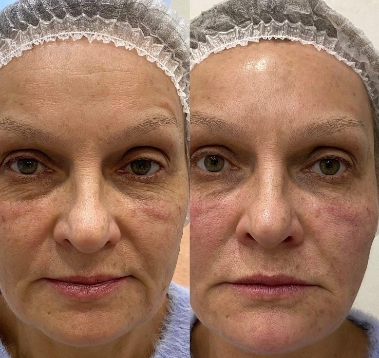 Студия красоты Pro Visage в Санкт-Петербурге: Парикмахерская, Маникюр, Эпиляция, Массаж, Брови, Ресницы, Косметология, Инъекционные процедуры, Перманентный макияж,