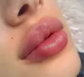 Миниатюра 14