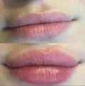 Миниатюра 24