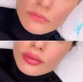 Миниатюра 10