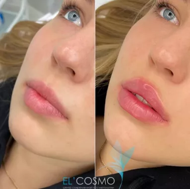 Центр современной косметологии Оксаны Самойловой "El`cosmo".
