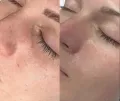 Миниатюра 14