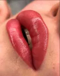 Миниатюра 7