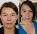 Миниатюра 5