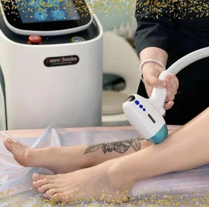 Эпиляция "LaserLux".