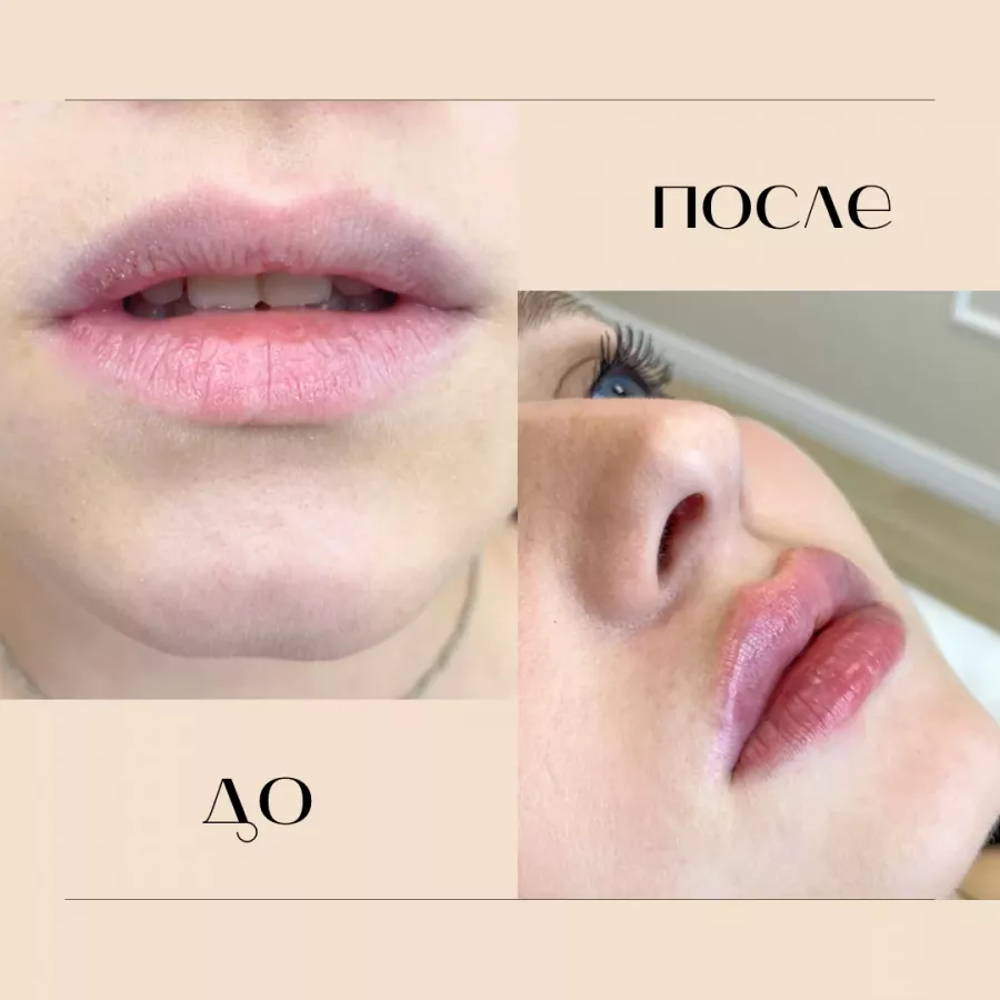 Клиника эстетической косметологии Ma Beauté в Владивостоке: Косметология, Лазерная эпиляция, Коррекция фигуры, Пилинг, Epilation, Cosmetology,