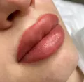 Миниатюра 4