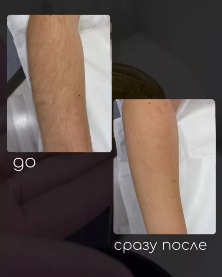Центр шугаринга SUGARING CENTER в Владивостоке: Эпиляция, Лазерная эпиляция, Восковая эпиляция, Волосы, Sugaring,