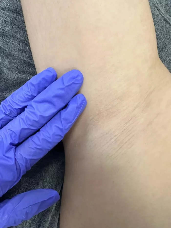 Эпиляция "Your laser Mama".