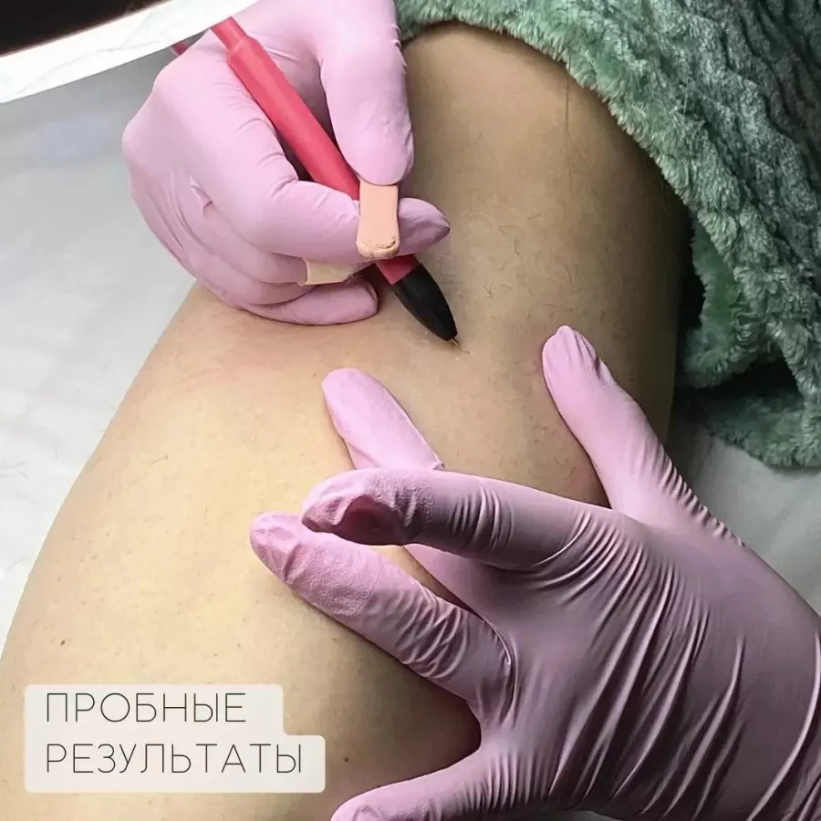 Электроэпиляция Epil Beauty в Ростове-на-Дону: Электроэпиляция, Эпиляция, Косметология, Депиляция,