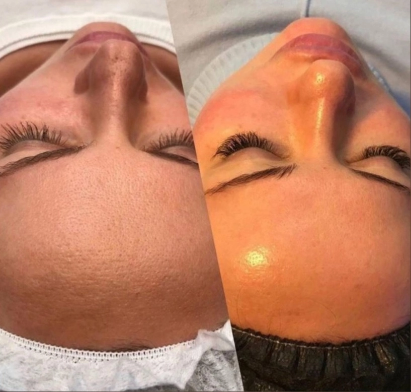 Студия красоты Beauty Bar в Туапсе: Лазерная эпиляция, Выезд на дом, Мужской маникюр, Свадебные прически, Массаж, Инъекционные процедуры,