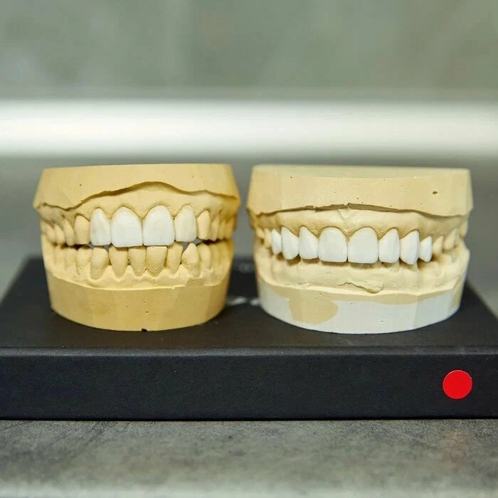 Стоматология Dental Sun Clinic в Сочи: Зубы, Ортодонт, Лечение кариеса, Установка имплантов, Виниры,