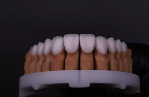 Стоматологическая клиника "Digital Implant clinic"