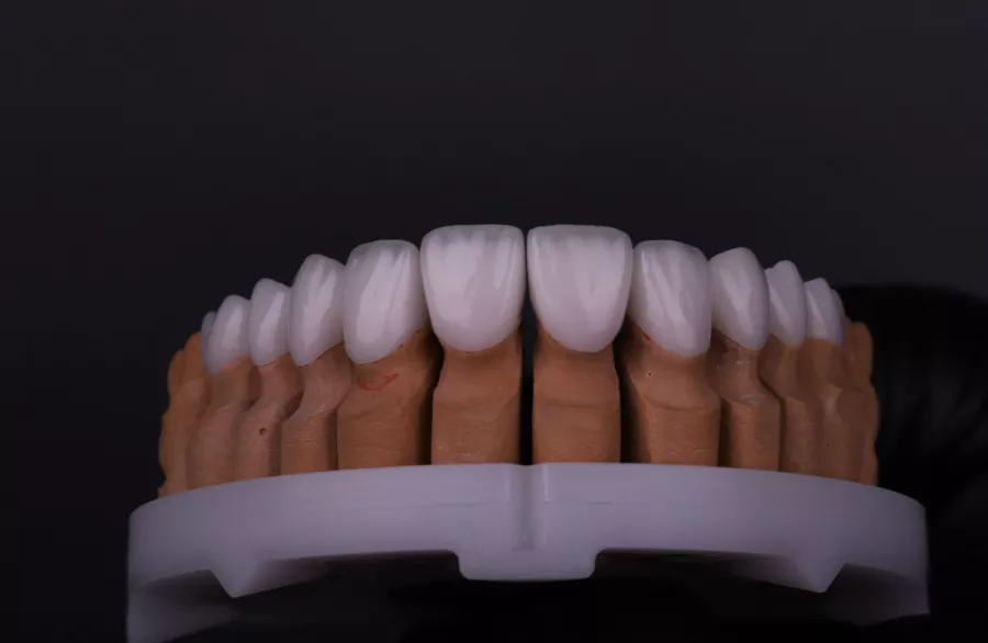 Стоматологическая клиника Digital Implant clinic в Дубаи: Импланты зубов, Виниры, Чистка зубов , Импланты зубов , Здоровые зубы ,