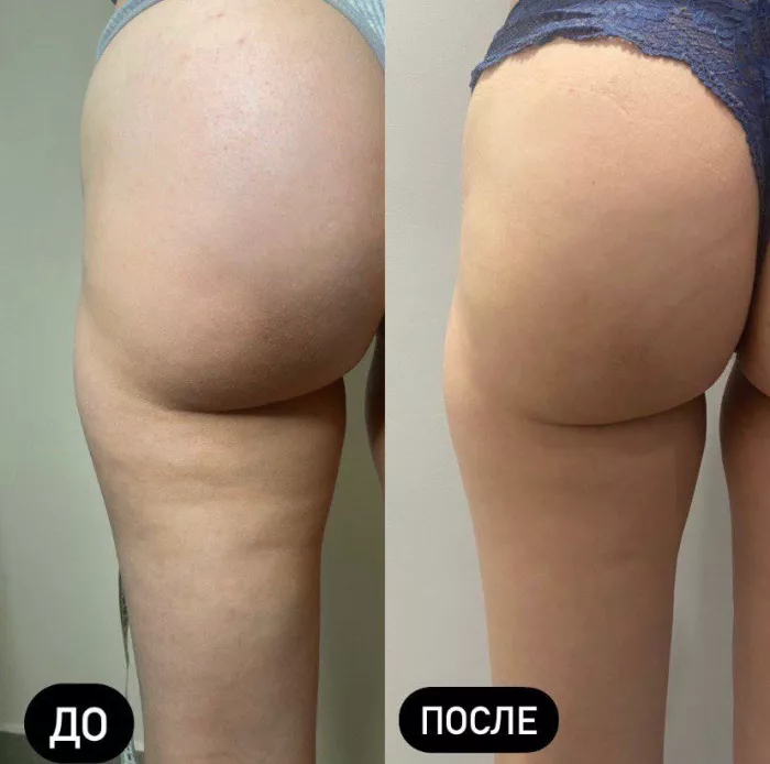 Массажный салон "Dolls"