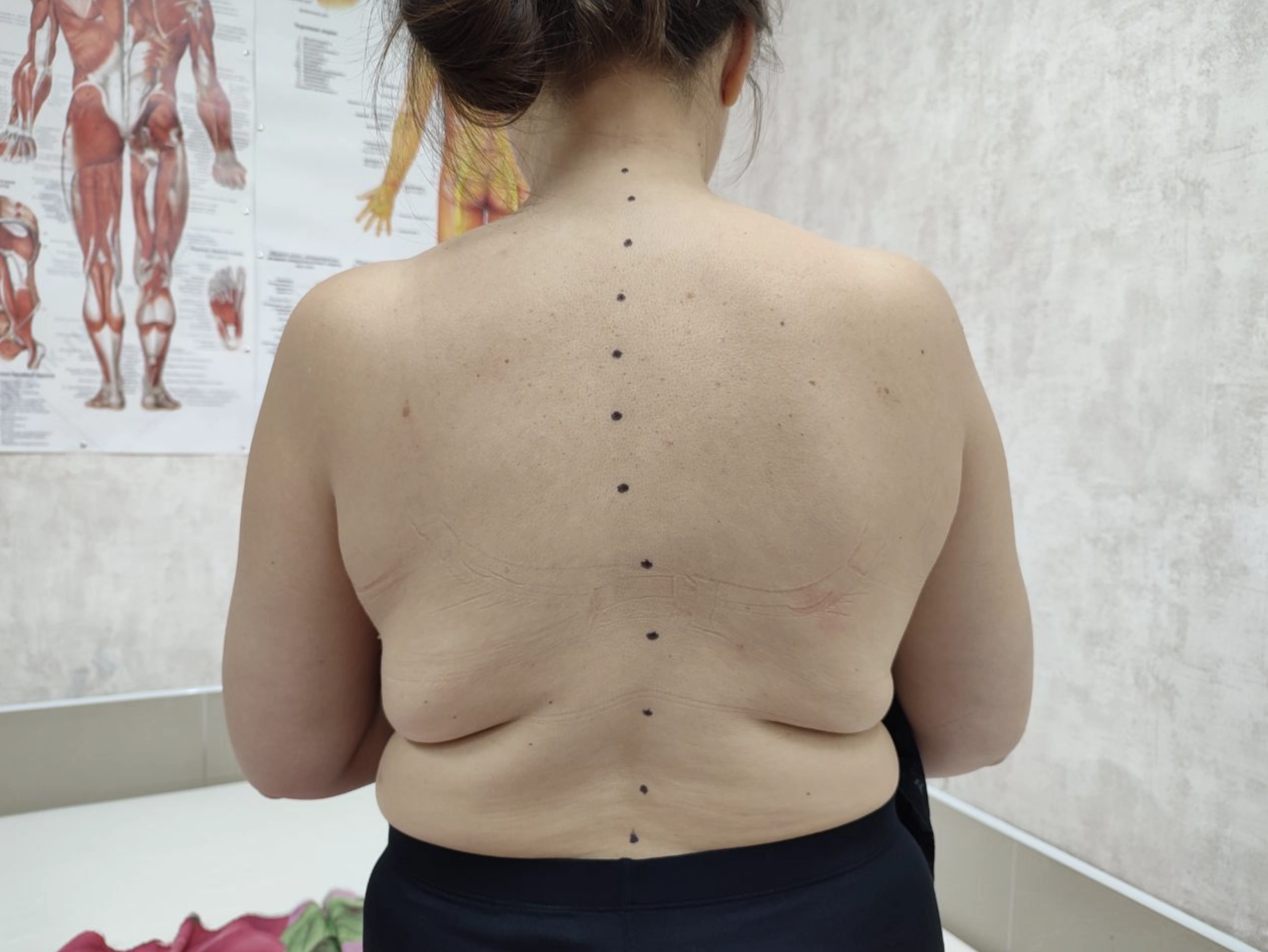 Уберу боль в суставах